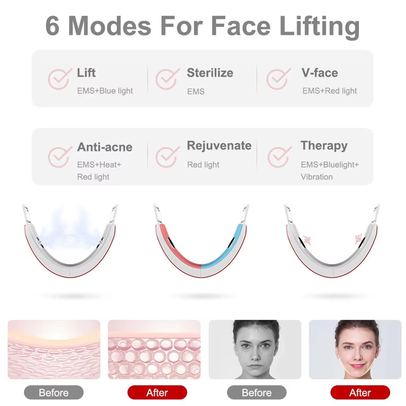 Facial Lift and Contouring Device with LED Light Therapy for Cheek Slimming and Double Chin Reduction